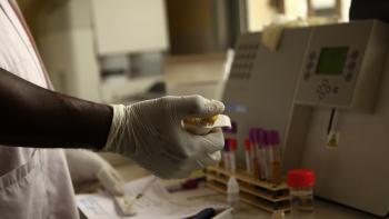 Coronavirus : l’AFD et l’Inserm mettent en oeuvre un dispositif de soutien de 1,5 million d’euros pour l’Afrique francophone